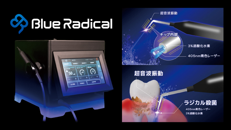 Blue Radical（ブルーラジカル）